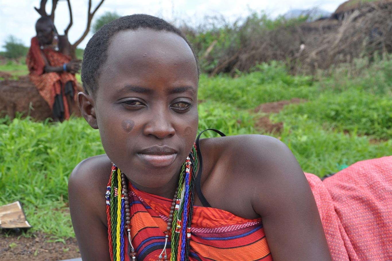 世界卫生组织 盘尾丝虫：专害穷人失明的可怕寄生虫，人类灭其子孙将其解决