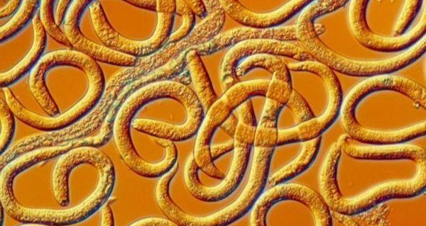 翟文利说育儿|孩子肚子里有蛔虫，有哪些症状？