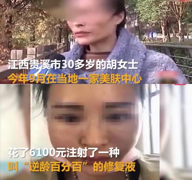 好物官|为抗老去美容院注射“逆龄修复液”的胡女士,如今怎样?事与愿违