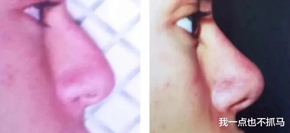 孙艺珍|10年花了「一千万整容」，他成为了「芭比真人男友」！