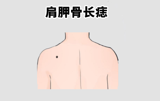 中国易经风水|“千金难买5颗痣”，一个聚财，一个添福，福泽子孙几代人！