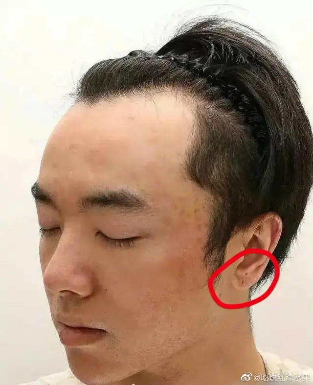 华晨宇|华晨宇整容、出轨、打胎实锤了？