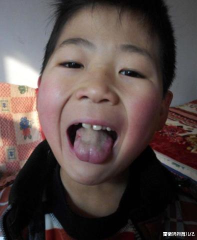 蔷薇妈妈育儿记|提醒父母：孩子这3种食物吃太多，孩子容易不消化，要注意