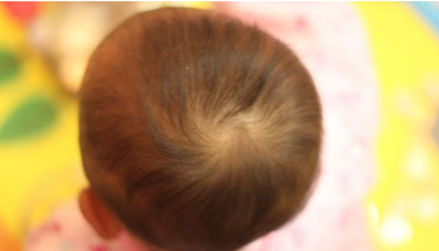 社会E站 为啥有的孩子头顶一个“旋儿”，有的则好几个？原因家长要了解