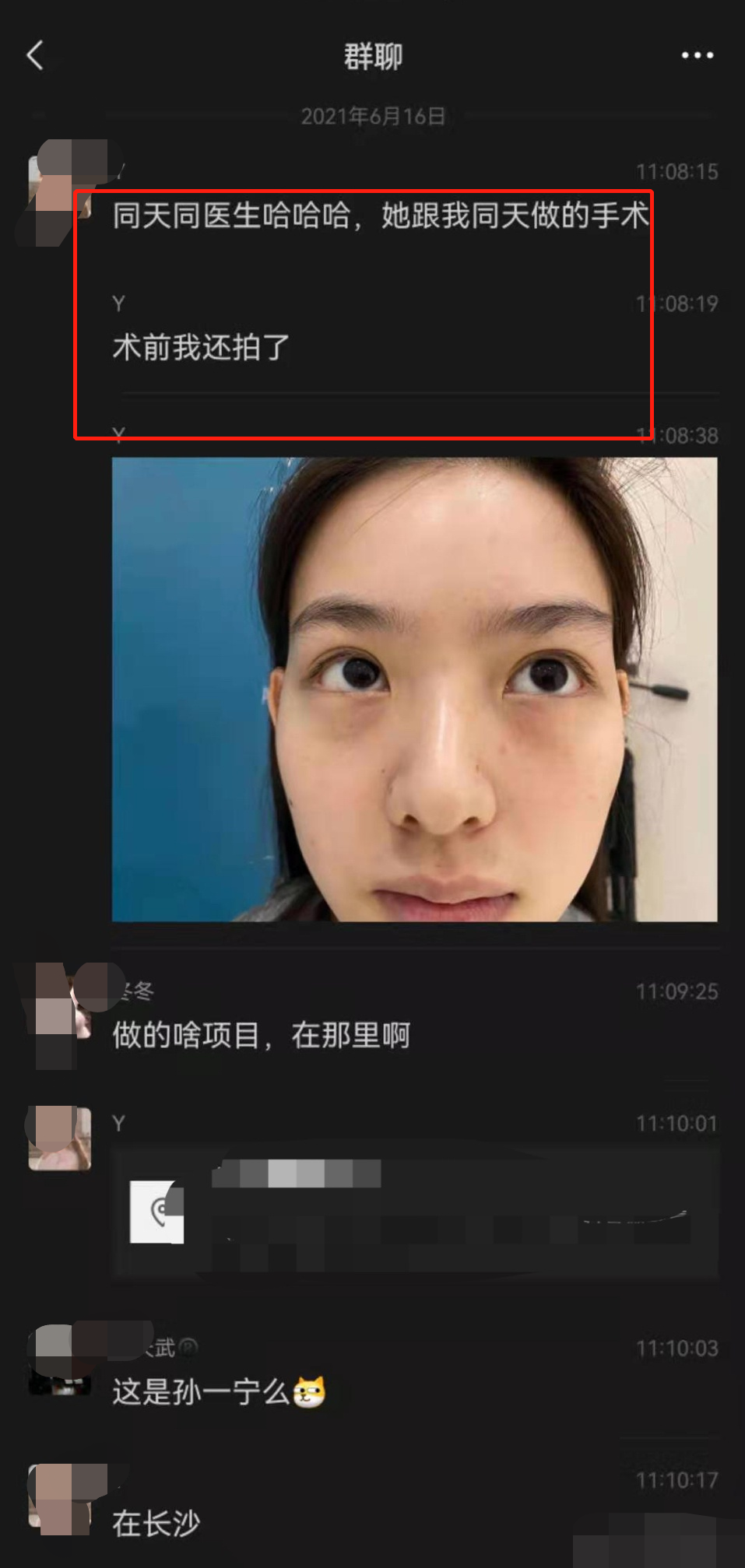 孙一宁|孙一宁整容疑添实锤，网友曝其手术前后照片，动刀之后纱布还在