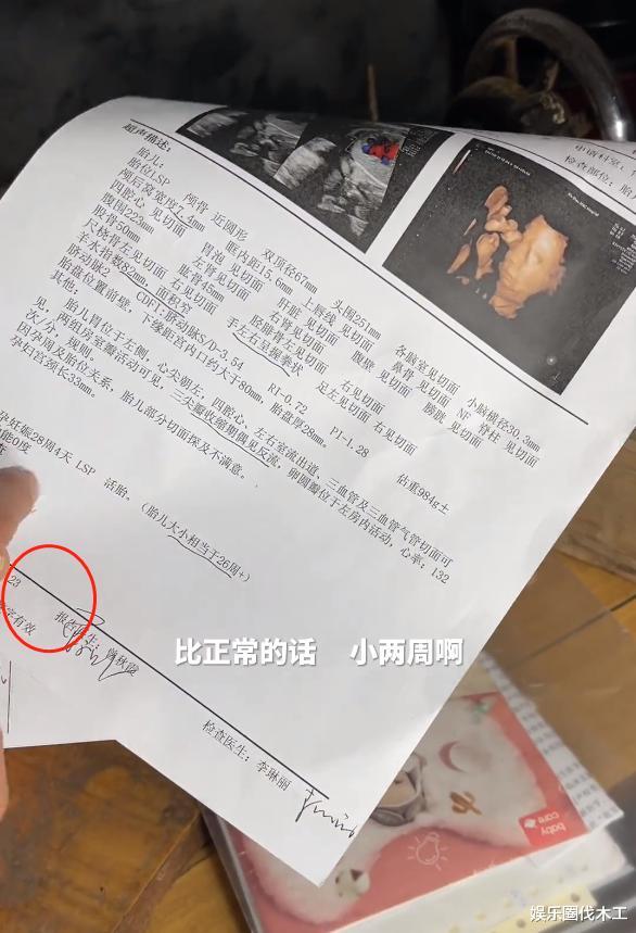 人物设定|小春花B超单子曝光，日期却成了“隐私”，网友：到底给不给看？