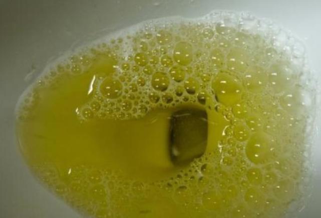 江湖微谈 不管男女,身体出现这3种症状,说明你的肾脏“病变”了