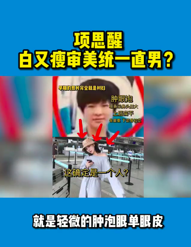 项思醒|项思醒整容前后差异大！UP主分析其做了10个项目，全脸基本都动过