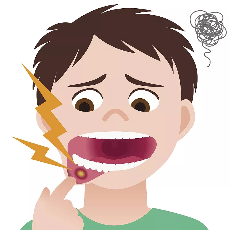 范提司|又长溃疡了？说话都痛？预防很重要！