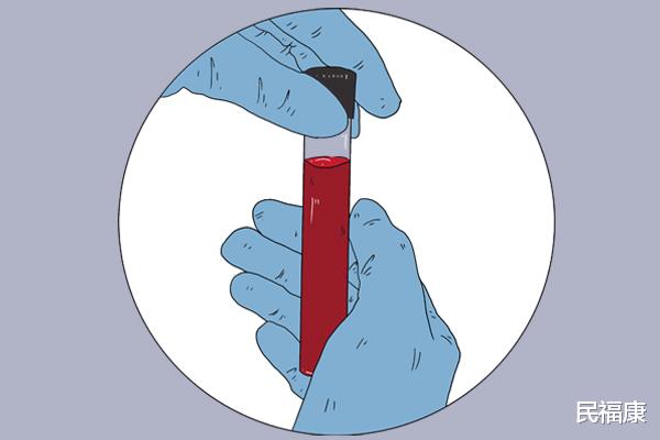 胆固醇|研究:适量食用核桃,降低胆固醇,关于核桃的妙用,一文带你了解