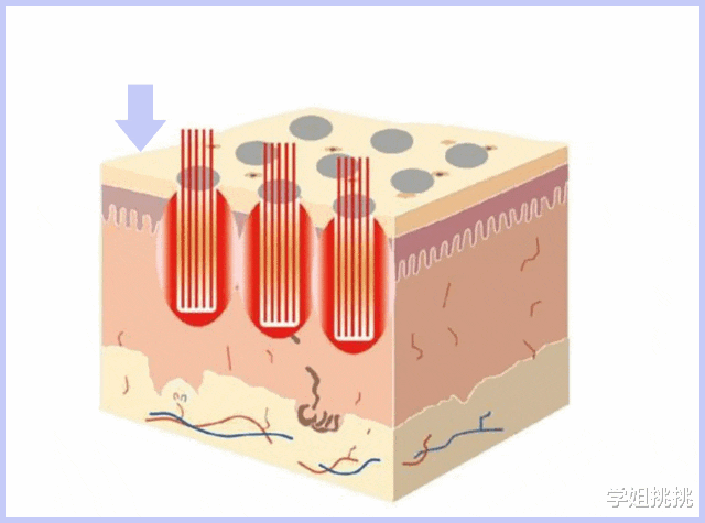 秦海璐|原来秦海璐也是“生图杀手”，以前低估她的颜值了