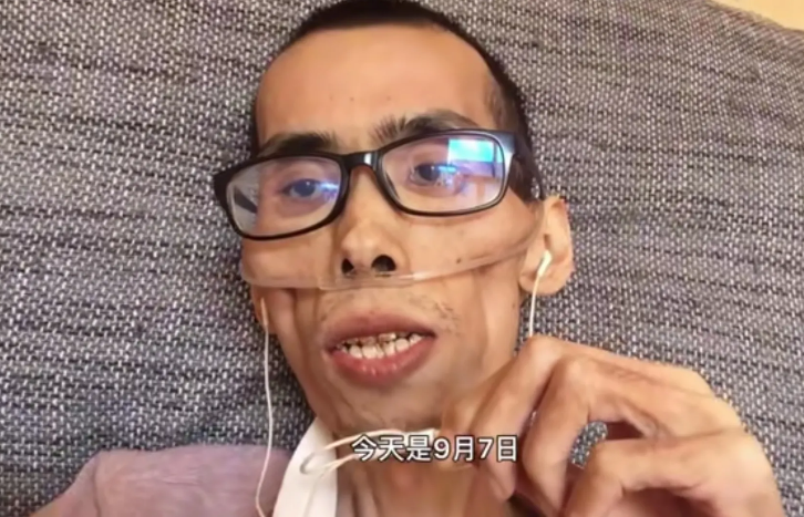 抗癌|噩耗！抗癌网红阿健病逝，生病前后判若两人