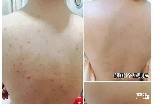 李佳琦|46岁林志颖自曝“不老童颜”秘诀：不打针不吃药，坦言护肤无非2点