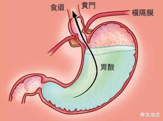 养生杂志|38岁男子，确诊胃病晚期，痛苦离世，医生：身上2处“反常”，被他无视