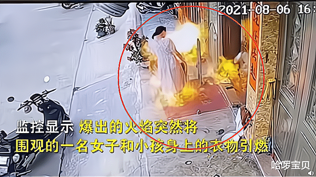 哈啰宝贝|好奇的代价:广东妈妈带孩子看邻居用酒精炉烤鱿鱼,双双被烧伤