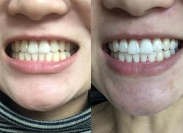 口腔大讲堂|电动牙刷怎么选？护理博主良心点评电动牙刷十大名牌！