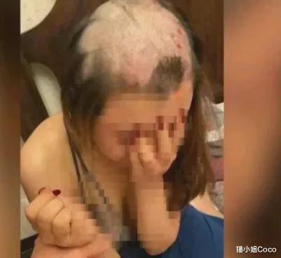 猫小姐Coco|女子被剃秃头逼迫承认有二心：真爱一个人，不会以爱之名伤害
