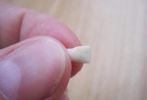 全能辣妈plus|孩子这颗牙有大“作用”，父母别再乱丢了，关键时刻能救娃一命