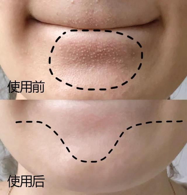 t恤 长期清水洗脸和洗面奶洗脸，皮肤“差距”会有多大？看后恍然大悟