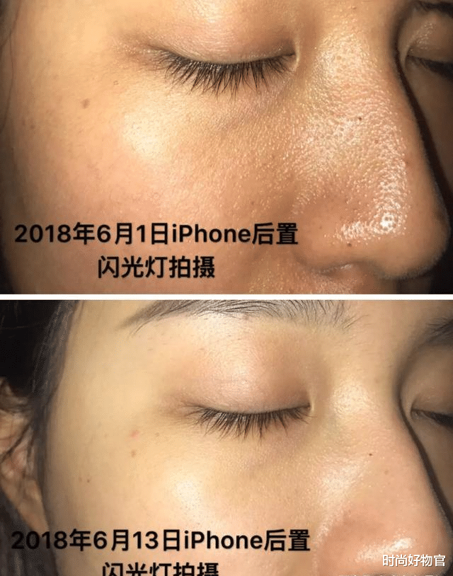 祛痘 51岁许晴比41岁章子怡还惊艳，皮肤白到发光！直言护肤方法很好用