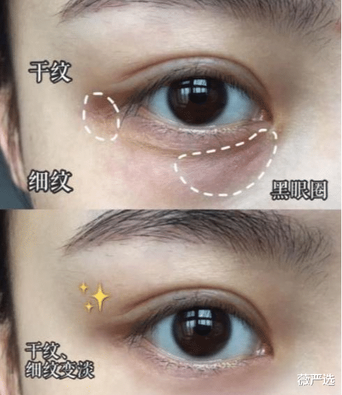 蛋白质|戚薇晒出屈臣氏镇店之宝，李佳琦：已用2年，吴昕：眼霜界爱马仕