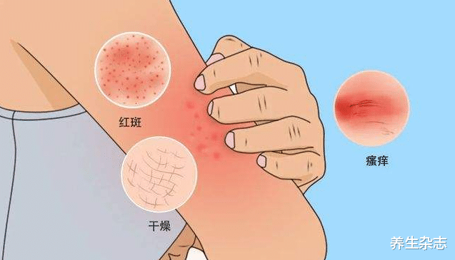 医生|外卖小哥浑身瘙痒，2个月后查出甲状腺结节，医生：身体2处发痒，尽早排查