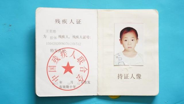 女子意外怀孕后不顾反对生下双胞胎,专家断言:活不过18岁!