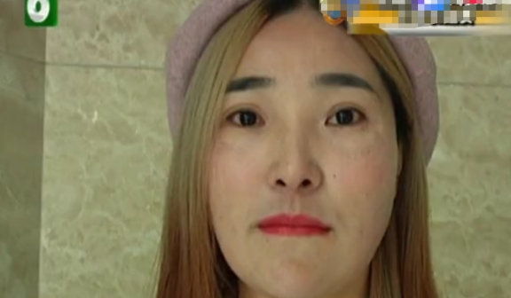 林依晨 女子嫌自己脸大想微调一下，花了6万，保质期只有2个月？