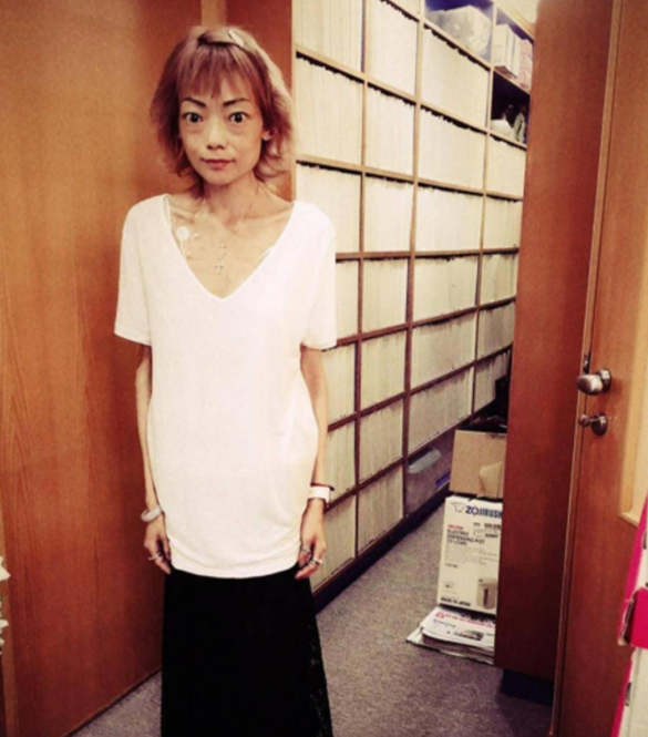 豪门|因丈夫3个字摘掉肠胃，嫁入豪门8年瘦到44斤，伍智恒经历了什么