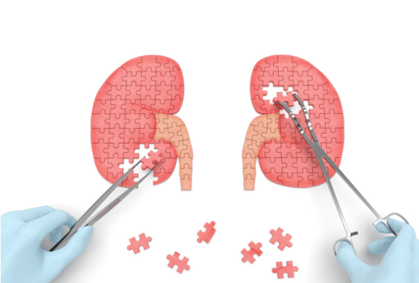 肾病|肾病3a期严重吗?肾内医生给出答案,摆脱尿毒症最后希望