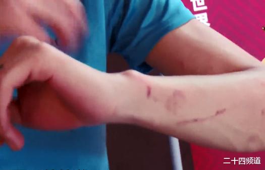 二十四频道 长沙9名同学结伴玩密室逃脱，结果被电击、勒伤，2名女生获得赔偿