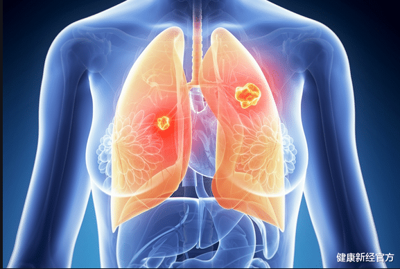 健康新经官方|吃1口等于吃10斤牡蛎，医生建议：老烟民不妨多吃，越吃肺越干净