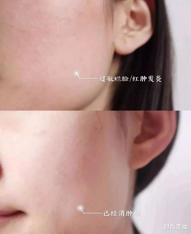 张馨予|32岁张馨予素颜比化妆还嫩？学她护肤，敏感肌也能变“水光肌”