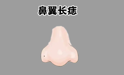 中国易经风水|身上4颗“苦”痣，打一辈子工，三餐吃不饱，脚下无房，没后福！