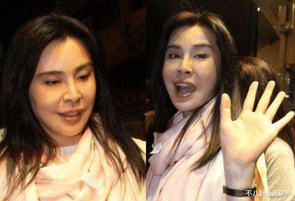 金晨|美人脸却败在鼻子上？这15位女星鼻子突兀，太可惜！