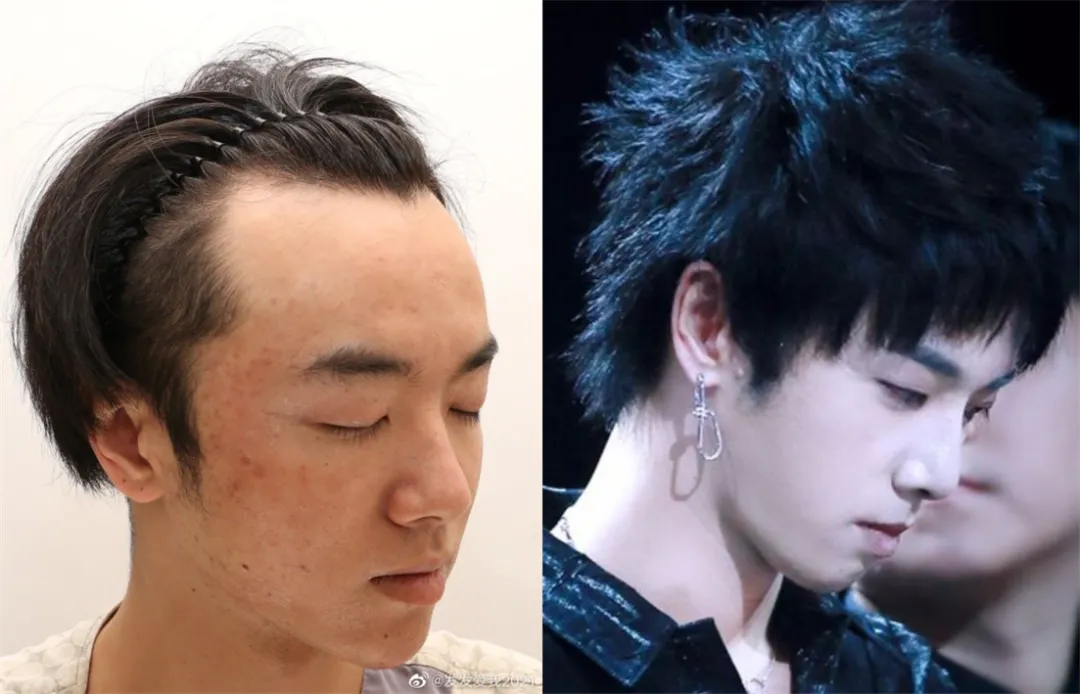 华晨宇|华晨宇整容、出轨、打胎实锤了？