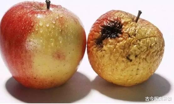 古今医案研读|这3个部位散发“臭味”,肝脏或已“烂如蜂窝”一个不占,肝还“强壮”