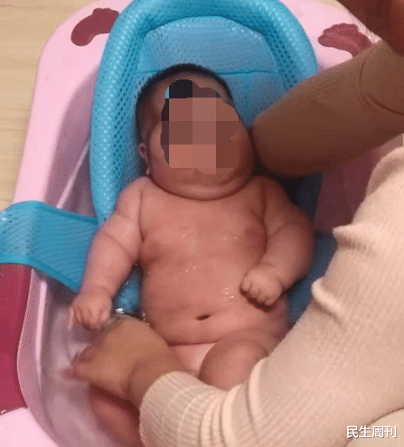 民生周刊 青島出現(xiàn)大頭娃娃！孩子體重猛增還長(zhǎng)毛