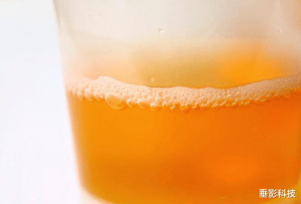 肝脏|医生提醒:身上长出这2种“小红点”,可能是肝在求救,别大意了