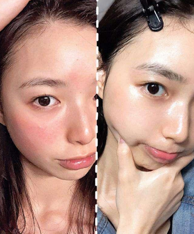 好物官|为什么不建议女生打“美白针”？专家说出实情，网友：幸好没跟风