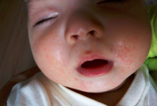 糖果的妈妈|“撕嘴皮”的孩子不怕痛吗？小动作中藏着许多原因，家长了解几个