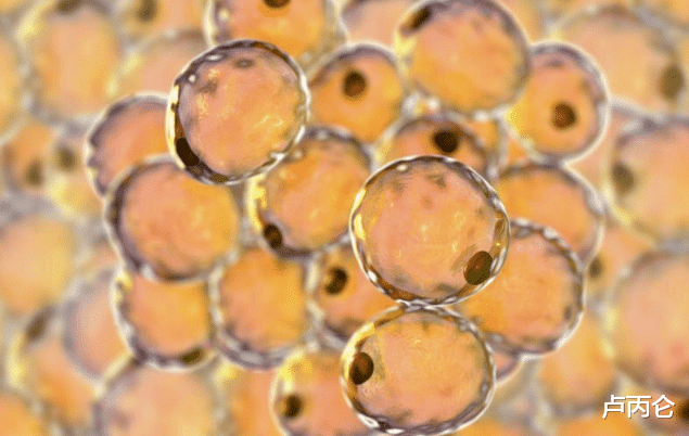 卢丙仑|吸过脂后为什么还会长胖？