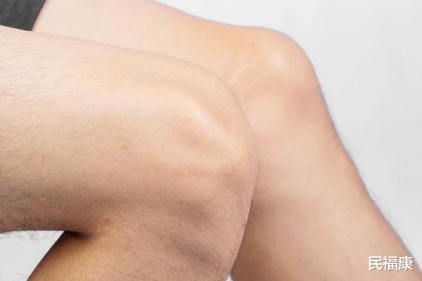 肝炎|日行万步才是锻炼？错了，最佳步行数也有讲究，记住“2宜2忌”