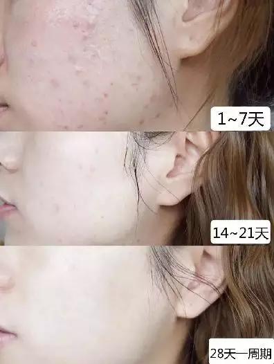 电视剧 “清水洗脸”和“洗面奶洗脸”，哪个对皮肤更好？原来我洗错了