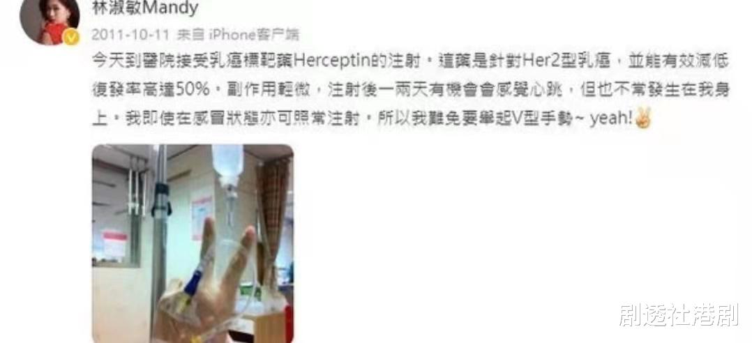 谭松韵|抗胜病魔！TVB知名女星曾患上乳癌，因化疗头发掉光还不敢告知家人