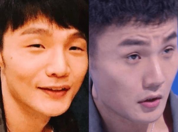 李荣浩|双眼皮对颜值有多大的影响？眼睛变大一倍，李荣浩的春天来了！