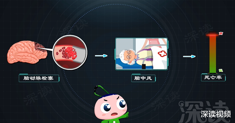 深读视频|久坐房颤发生率高5倍？酗酒、肥胖更易得房颤？房颤发病因素知多少