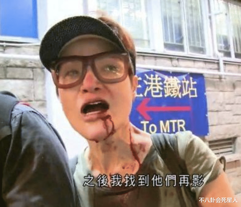 香港|香港过气女星现状：毁容破产、当保安、被当街暴打、瘦成纸片人