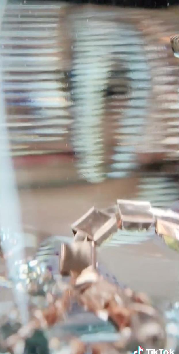 医生|脑门镶钻后，又有歌手钻开头骨植满大金链？网友嘲翻！