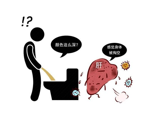 健康周谈|医生:小便出现2种异常或是肝癌早期信号,上完厕所记得看一眼!